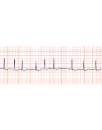 An update of managing patients with atrial fibrillation