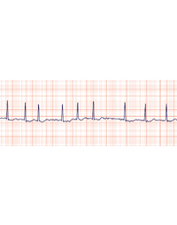 An update of managing patients with atrial fibrillation